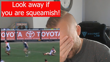 Rob Reacts to... Aussie Rules - AFL WORST INJURIES COMPILATION