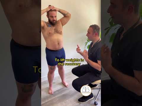 1 Year After A Tummy Tuck And Lipo By Dr Batal Lipo Tummytuckbeforeandafter Shortsfeed 