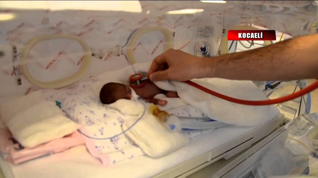 380 gramlık bebek yaşamak için direniyor
