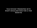Rotator cuff repair