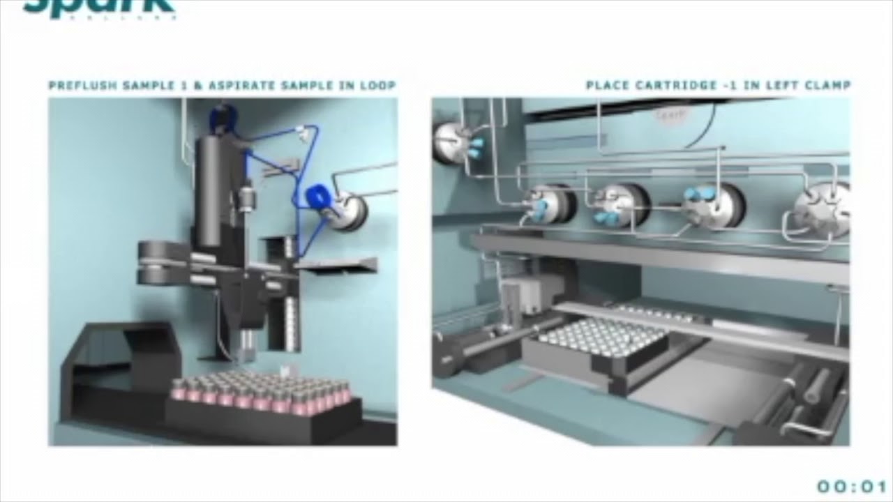 L’automatisation SPE