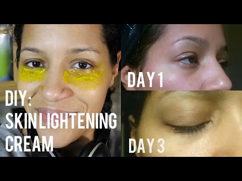 DIY: Natural Skin Lightening Cream to Get Rid of Dark 