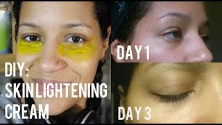 Diy: Natural Skin Lightening Cream To Get Rid Of Dark Circles - Youtube