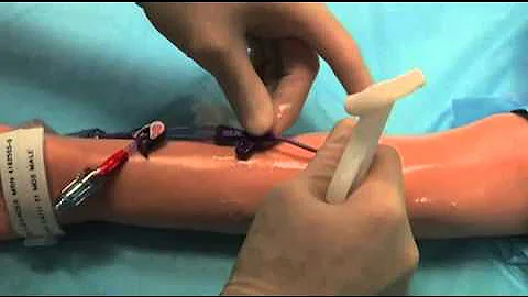 Peripherally Inserted Central Line Catheters & Mid-line Catheters - 1