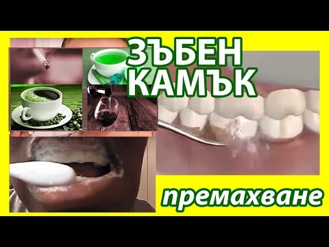 Видео: Как да премахнете зъбния камък: 10 стъпки (със снимки)