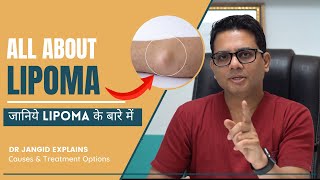 All About Lipoma | What are the causes and treatment options for Lipma | Lipoma Surgery in Delhi