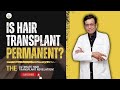 Is hair transplant surgery permanent  dr sandeep bhasin  care well medical centre