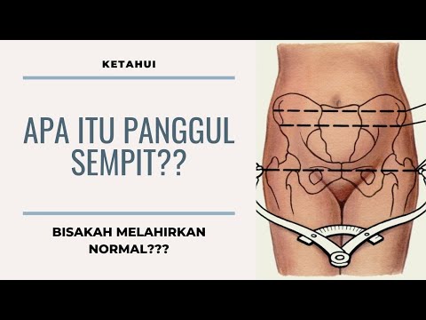 APA ITU PANGGUL SEMPIT?