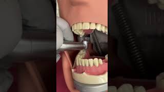 Crown prep tips