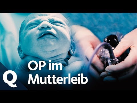 Video: Babypositionen Im Mutterleib: Was Sie Bedeuten