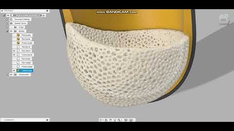 Brep solid flexible and frame prosthetic sockets with lattice distal end pad, Meshmixer & Fusion360