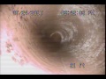 Sewer Inspection Video - Hilger