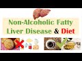 Non-Alcoholic Fatty Liver Disease & Diet | Diets to Prevent and Reduce Severity of NAFLD