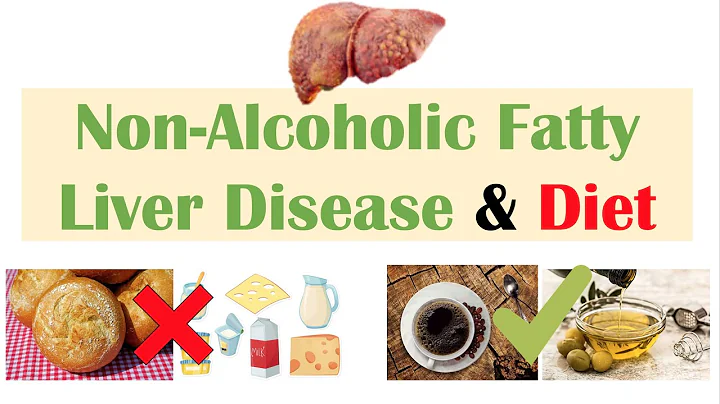 Non-Alcoholic Fatty Liver Disease & Diet | Diets to Prevent and Reduce Severity of NAFLD - DayDayNews