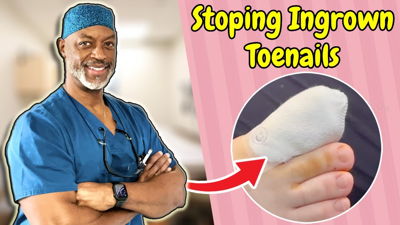 👣 Stop Ingrown Toenails from Coming Back | Prevention That Works ✅