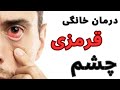 درمان قرمزی چشم روش های خانگی برای درمان قرمزی چشم که نمیدانستید 