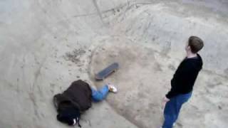 One Broken Face, Please. SKATEBOARDING FAIL