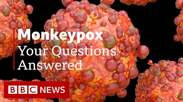 Monkeypox: Your Questions Answered - DayDayNews
