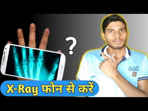 Hindi] Best Real X-rays Body Scanner App for Android | How to download X-rays  App | cloth removing - YouTube
