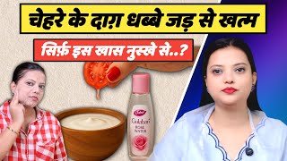 चेहरे के दाग धब्बे एक ही दिन में जड़ से ख़त्म होंगे | Best Home Remedy For Dark Spots