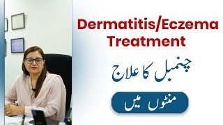 Dermatitis/Eczema Treatment in Urdu/Hindi - Chambal ka ilaj - Prof. Dr. Nadia Ali Azfar