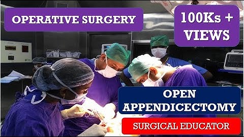 OPEN APPENDECTOMY/ STEP BY STEP OPERATIVE SURGERY