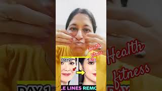 face yoga exercise for removing smile lines #antiaging #glowingskin#faceyoga #laughtlines#smilelines