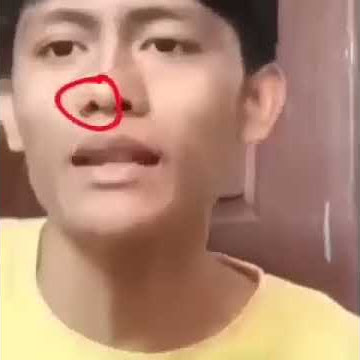 Telaso Lalat Anjing Binatang