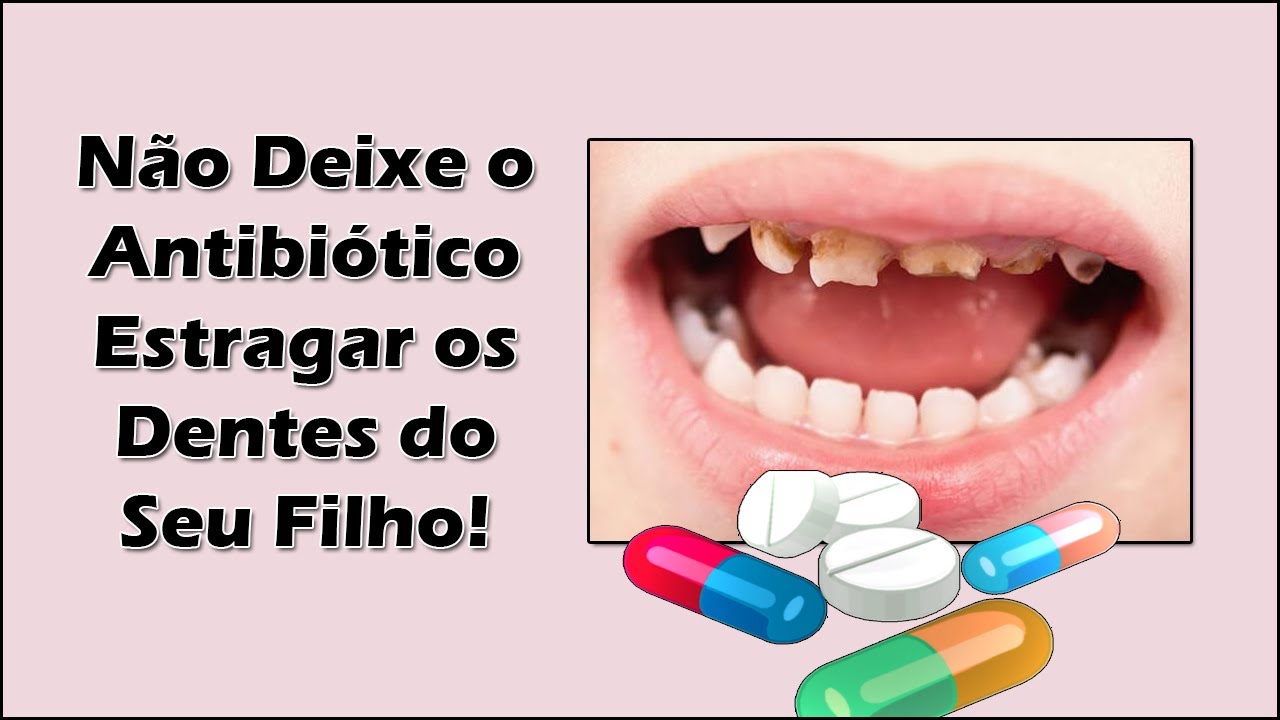 CUIDADO: Não Deixe o Antibiótico Estragar e Enfraquecer os Dentes do ...