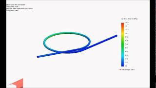 expansion loop concept ANS
