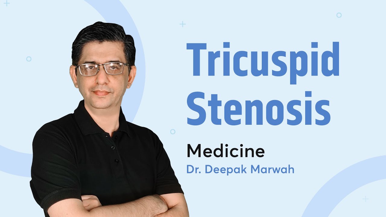 Tricuspid Stenosis | Dr. Deepak Marwah | Medicine | PrepLadder