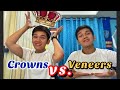 CROWNS VS VENEERS: Alin ang mas okay?