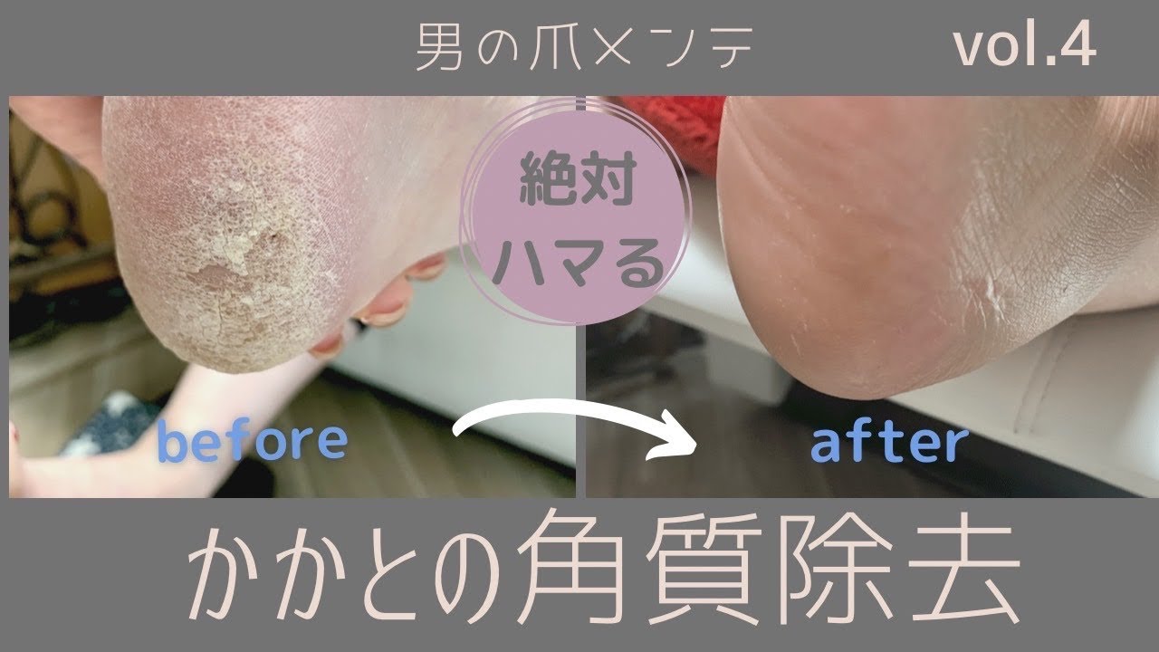 【footcare】【フットケア】驚愕のこびりつき！かかと角質除去動画！