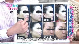 婆媳當家 大總檢!我的臉不能看? 20151215 part4