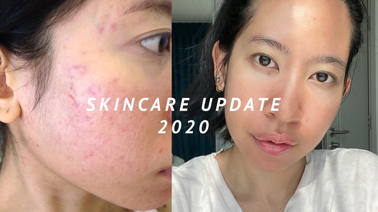 ครีม ที่ นิยม มาก ที่สุด  Update New  REVIEW l Skincare Update 2020 ผิวเป็นสิว มัน รูขุมขนกว้าง แพ้ง่าย