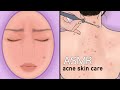 Asmr acne skin care animation  roleplay  pimple popping relaxing