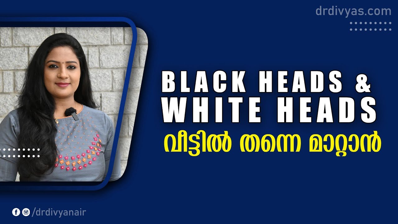 മുഖത്തെ കാര അകറ്റാം വീട്ടിൽ തന്നെ | Remove Blackheads, Whiteheads, Open Pores | Working Home Remedy