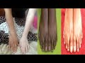 Kua mweupe Mwili mzima kwa kutumia vitu asili | whitening remedies miracle result at home |ENG SUB