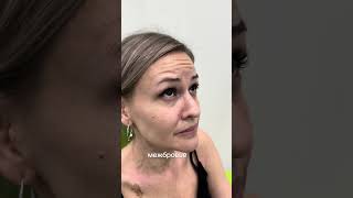 #botox #ботулинотерапия #косметологиямосква