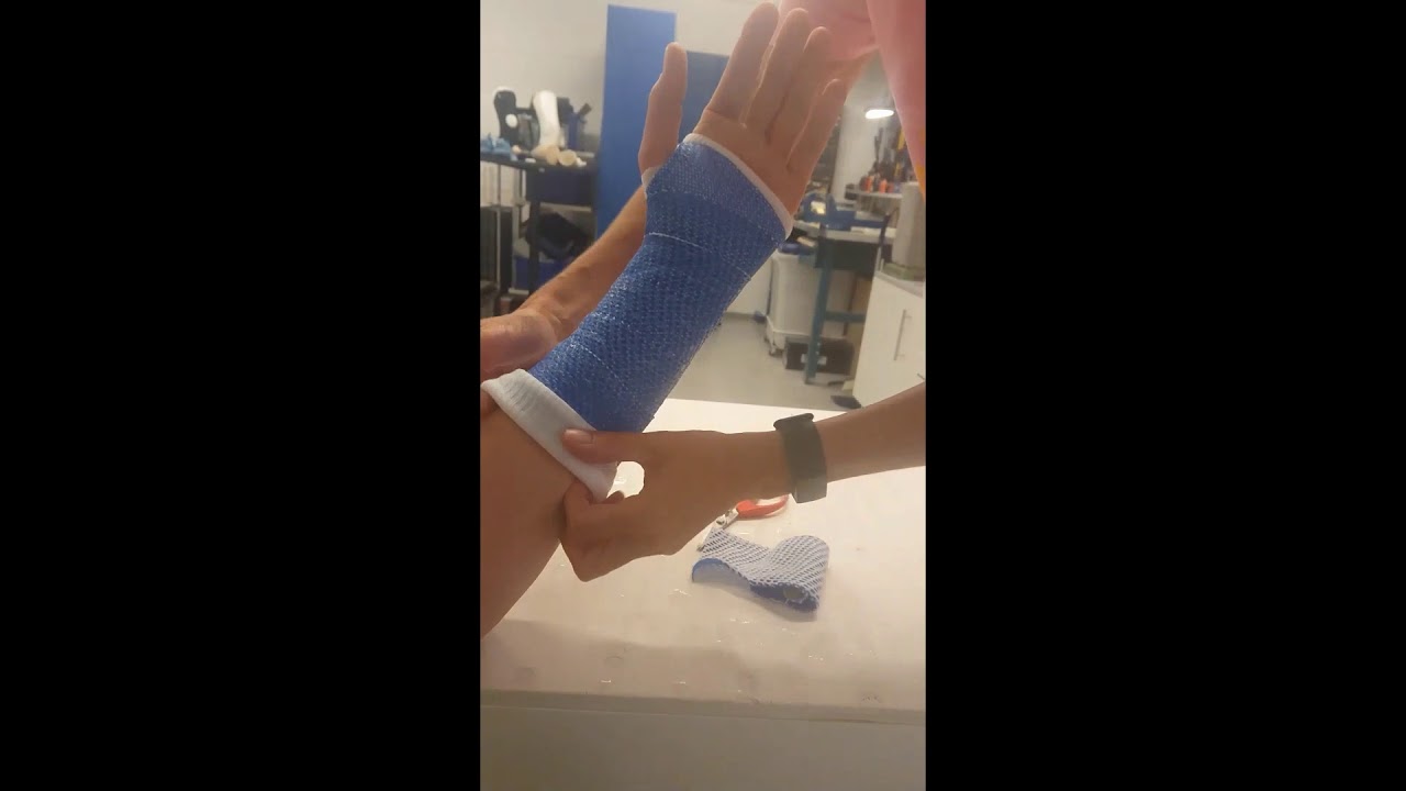 X-LITE® PLUS Wrist Cast