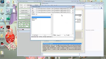 5 fMRI SPM Normalize functional