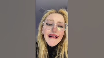 ¿Se pueden usar BRACKETS y PIERCINGS en el labio? ESTA IMAGEN lo resuelve