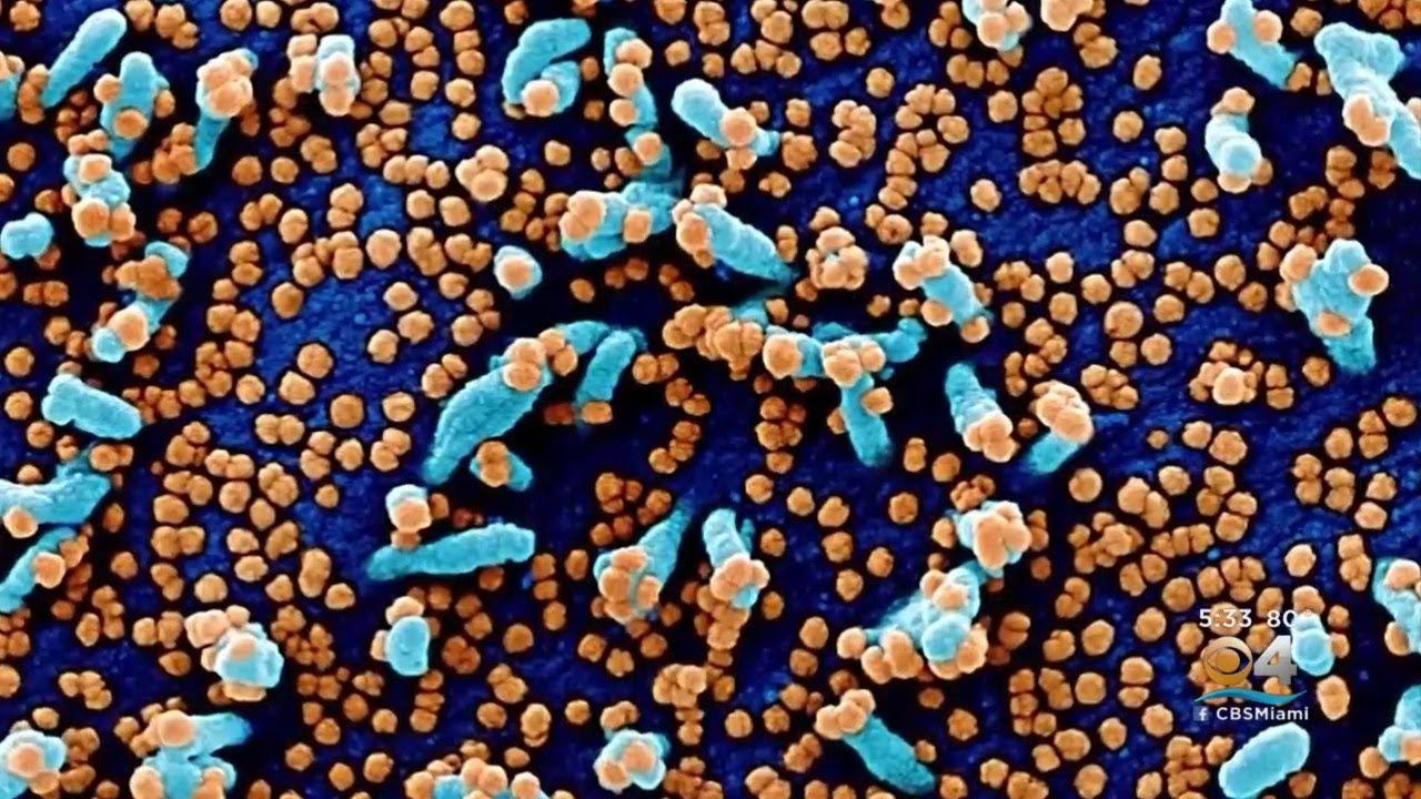 Total Number Of U.S. COVID Deaths Hits 800,000