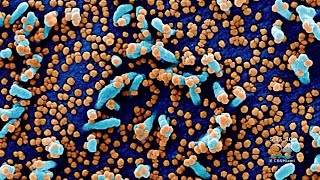Total Number Of U.S. COVID Deaths Hits 800,000