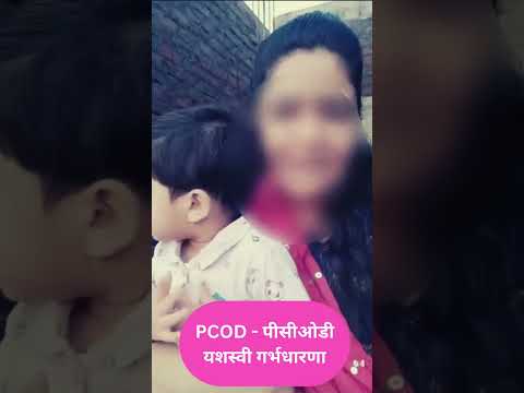 PCOD successful Ayurveda treatment