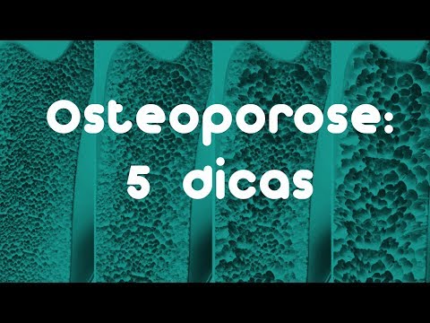 Vídeo: 3 maneiras de prevenir a osteoporose
