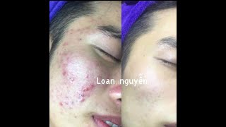 Loan Nguyen  1