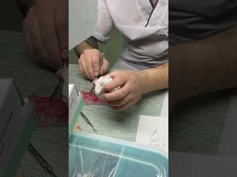 Моделирование зуба под штампованную металлическую коронку #зубнойтехник #рекомендации #врач #врек