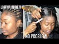 LOW Hairline Problems? (MOST REQUESTED VIDEO!)