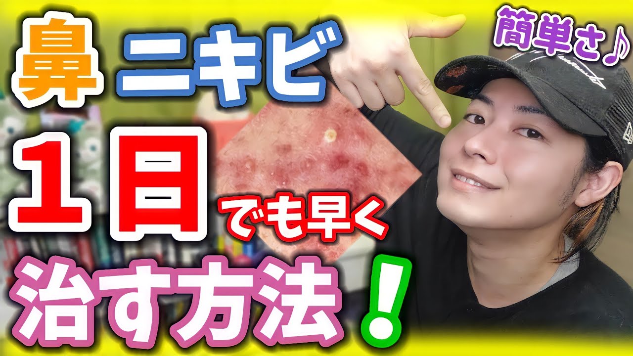 美肌 鼻の頭にでかいニキビ 1日でも早く治す方法 意外な原因 Youtube
